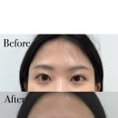 강동-천호-127 이미지