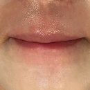 유이뷰티 | [부천왁싱] 인중 레이저 실패하고 ‘뷰티유이’ 왁싱으로 갈아탄 후기