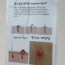 솜솜뷰티 | 천안 두정동 왁싱 💛 브라질리언 처음인데 이렇게 편할 줄 몰랐어요! (솜솜뷰티 후기)