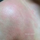 스트레스 타파 마음건강 찾기 | [토피타파 2탄/사진有] 동양의학의 손을 잡고 리바운드의 무서움을 직면하다