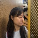 청담아이(i)성형외과의원 | 아이라인 성형외과 I 에어젯2 리프팅 솔직 후기✨