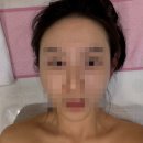 미당 에스테틱 | 강남피부관리 더윤에스테틱에서 윤곽관리 받고 온 후기