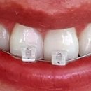 이앤장치과교정과치과의원 이미지