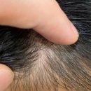 헤어온의원 이미지