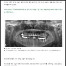 타임치과의원 | 수유역 치과 선택 전, 꼭 알아야 할 두 가지 기준!