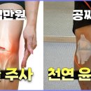 무릎 통증 비싼 연골주사 계속 맞으실 건가요? 윤활액은 몸에서 만들어 집니다. 이미지