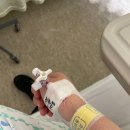 히딩크드림필드화장실 | 아주대병원 담낭절제술 복강경 수술 후기, 수술 후 식단, 후유증