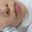 메디스킨 | 동성로피부관리샵 데자뷰메디스킨 후기 직장인 퇴근후 수분재생관리