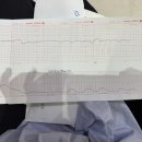 분당-36 | [임신 36주차] 분당제일여성병원 막달검사 후기, 자연분만 도전! 첫 태동검사