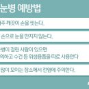 명동서울밝은안과의원 이미지