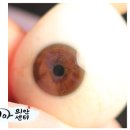 코리아의안센터 이미지