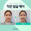 약손피부관리 - 달성군 | 약손피부관리