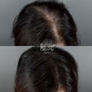 모리샵 일산본점 - 두피문신으로 자신감을 되찾으세요!