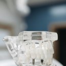 바른이정치과의원 | 바른이정치과의원 – 빠르고 친절한 중계동 치과 진료