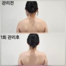 구로-구로-구로-2366 | 확실히 회복에 도움도 되고자세가 곧아지는 느낌을 받을수 있어요!