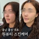원뷰티스킨케어홍성