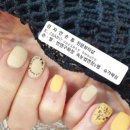 강자안손톱 이미지