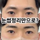 부평종합시장 관리사무소 | 부평남자눈썹정리, 밀기만 하면 끝일까? 비용 후기