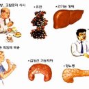 고지혈증의 원인과 증상 및 치료 예방법 이미지