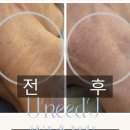 유니드케어 이미지