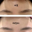 보드레왁싱 | 수유역왁싱 맛집 보드레왁싱 찐 후기