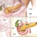 '침묵의 암살자' 췌장암, 이제 분변검사로 쉽게 진단한다 이미지