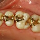 본치과기공소 이미지