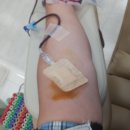 Blood donation done just before 이미지