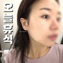 휴식 | 인계동 피부관리 오늘휴식 물방울리프팅 솔직후기