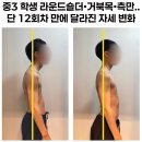 우리메디칼보조기 | 소아 척추측만증 초기 증상, 부모가 꼭 확인해야 할 신호들