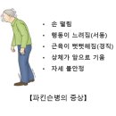 파킨슨병Parkinson's disease뇌신경정신질환 이미지