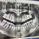 하남중앙치과의원 이미지