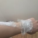 새살님오토바이 | 을지로흉터치료 내돈내산 2주 치료후기 - 명동흉터한의원 (feat. 이지혜 원장님)