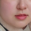 르에이치의원 이미지