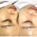 힐링케어 이미지