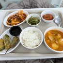 외상성 어깨 탈구 3탄 - 브리즈망