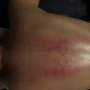 본에스테틱스킨&바디 | 부천 에스테틱 직접 받아본 사운드바디사운드스킨 관리 후기