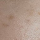 마포공덕에스앤유피부과의원 이미지