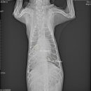 (주)한강메디칼 이미지