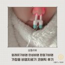 에스의료기 | 코감기 빨리 낫는법 만성 비염 노란 콧물 치료방법 홈케어 비염치료기 후기
