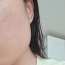 레드스퀘어 | 안면홍조원인 안면홍조크림 홍조시카크림 더마스퀘어 레드스킵 솔직후기