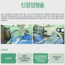 허리 신경성형술 후기