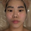 가안1미백주름림프경락두피탈모여드름케어마사지샵 | 관평동 에스테틱 추천｜글로위스킨 맞춤 피부관리 케라손 후기!