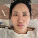 진접 피부관리 해밀피부전문점에서 비대칭교정하고 작은얼굴만든 후기