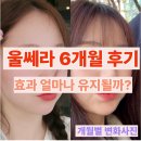 6 | 울쎄라 6개월 후기｜유지기간 실제 체감, 효과 언제까지 갈까?