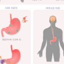 금연 금단현상 금연 시 나타나는 금단현상들 이미지