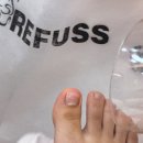 레푸스 범어점 | 발톱박리 엄지 레진젤 레푸스 범어점 내돈내산 후기