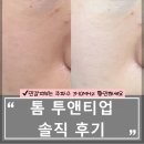 투앤티뷰티 | 톰 투앤티업 후기 | 민감피부가 3·10MHz만 보는 이유 + 올리브영 할인 정보