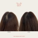 TMW 탈모왕수원 이미지