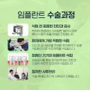 계양구 임플란트 후기 좋은 치과, 이 글만 보세요!